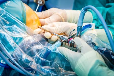Arthoscopic Surgery