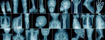 X-Ray imaging