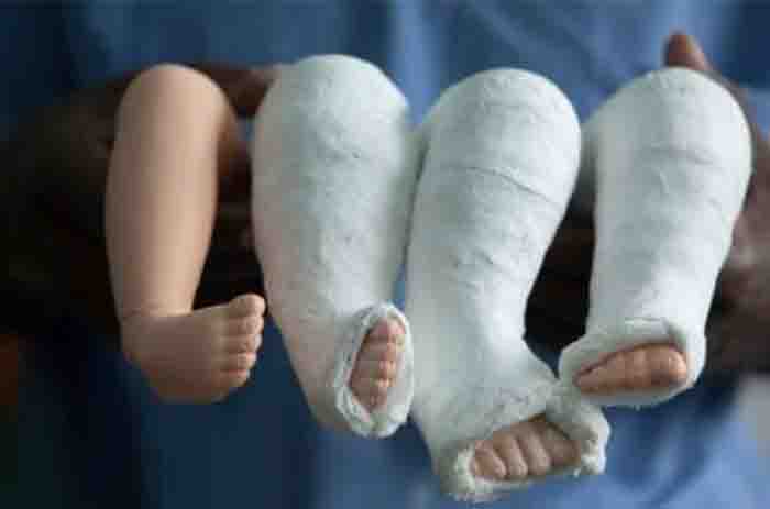 Paediatric Orthopaedic Surgery